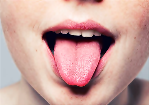 Alteraes-do-gosto-1565175083